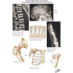 Runge IM 1E image