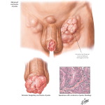 Labeled image