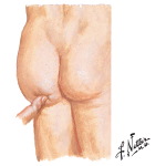 Physical Examination of the Pelvis