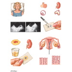 Assessment of Ovulation