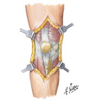 Knee