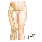 Quadriceps Angle Measurements