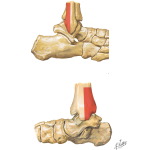 Ottawa Ankle Rules