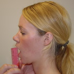 Measurement of Mouth Opening Active Range of Motion 
