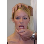 Identifying Patients With Craniomandibular Pain