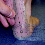 Measurement of Relaxed Calcaneal Stance