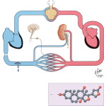 Heart Failure: Treatment