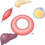 Type 2 Diabetes Mellitus