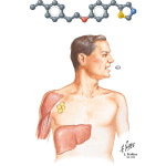 Thiazolidinediones