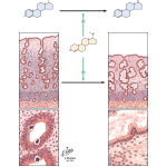 Role of Progestins In Hormone Replacement Therapy