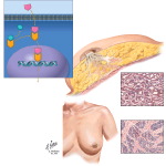 Cancer Risks