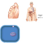 Nature of Fungal Infections and Therapy