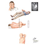 Herpesviruses
