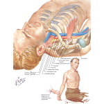 Labeled image
