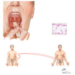 Adverse Effects of Chemotherapy