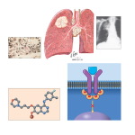 Gefitinib