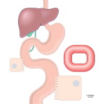 Fat-Soluable Vitamin-Drug Interactions