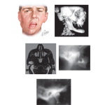 Unlabeled image