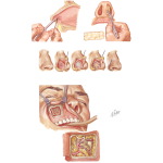 EPISTAXIS - Netter Medical Artwork