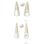Types of Teeth: Maxillary Incisors (Right Side)