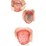 Tongue