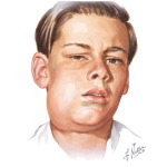 Abscesses
