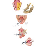 Mandibular Injections: Inferior Alveolar Nerve Block