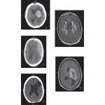 Neurodiagnostic Tests Used for Evaluation