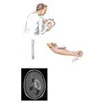 Initial Headache Evaluation