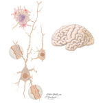 Alzheimer's Disease