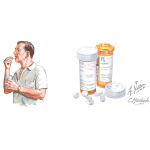 Drug-Induced Parkinsonism