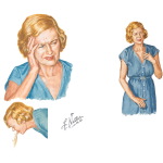 Migraine Headache