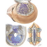 Venous Anomalies