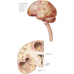 Labeled image