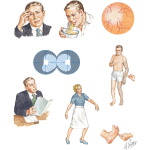 Some Common Manifestations of Brain Tumors