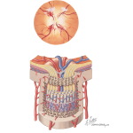 Ischemic Optic Neuropathy