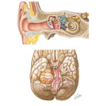 Acoustic Neuroma