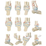 Fractures and Fracturing Forces