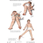 Labeled image