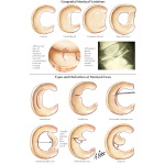 Labeled image