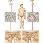 Testicular Failure V: Delayed Puberty