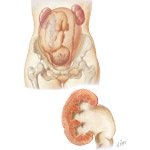 Urinary Complications
