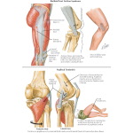 Popliteus Tendinitis - lliotibial "Band" Friction Syndrome