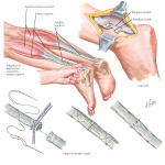 Labeled image