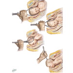 Rotation and Delivery