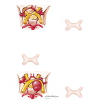 Lesions of Anterior and Posterior Chiasm