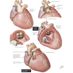 Labeled image