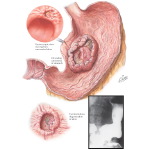 Labeled image