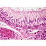 Light Micrograph of Pseudostratified Epithelium In the Epididymis