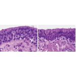 Light Micrographs of Stratified Columnar Epithelia